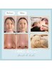 【全員】第一印象UPに◎【小顔矯正×毛穴洗浄】人気コンビで即実感憧れ小顔へ