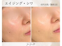 スリースリー(THREE THREE)/エイジング・しわ