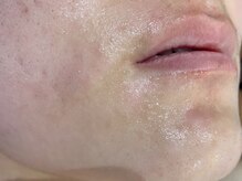 ラブ アンド ピース(Love&Peace)