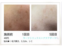 リル(Rire)/Before→After