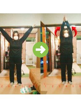 サプライズ整体院/30代ママさんの肩こり初回結果