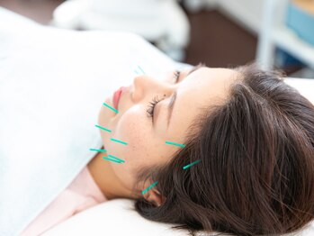 サロンラメール(Salon Lamer)の写真/（美容鍼サブスク）月３回整う人はキレイが崩れない　美容鍼２回×光ケア新習慣　巡りと再生　月9800円