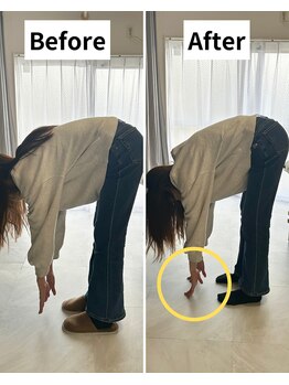 Root整体院【首・肩こり/腰痛/根本改善】/腰痛Before/After
