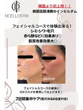 ヴィーナス 船橋駅前店(VENUS)/フェイシャルICD化粧品使用