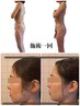 【施術一回】首肩こり・頭痛・不眠●小顔・骨格全身矯正180分66000→33000