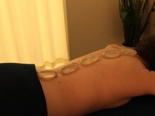 エステティックサロンアネラ(Anela)/水晶石を使用して…