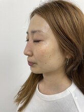 ナノハナ/鹿沼市の全身脱毛美容室ナノハナ