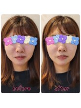 ピエール ナリタイラボ(Piel NARITAI LABO)/小顔整体