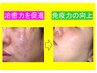 [顔]きれいな肌を取り戻す/メディ 修復マイクロカレント（生体微弱電流）30分