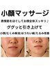 【再来６週以内】毛穴改善+小顔マッサージ+高濃度美容液導入 80分¥3,300オフ
