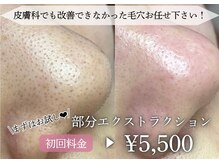 フェルナ(FERNA)