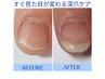 すぐ見た目が変わる【深爪ケア】人工爪で長さ出しクリアor自爪風