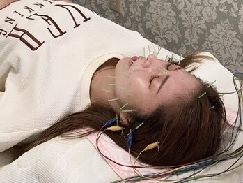 フジ鍼療所の写真/【血流UP!リフトUP!スッキリ小顔へ◇】美容鍼でお肌のターンオーバーを促進しお肌の細胞を活性化！