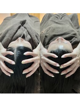 エルミオ エスパシオ ミロク(El mio espacio 369miroku)/頭皮が1ミリたるむと、、