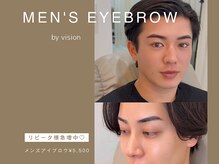 ヴィジョン(vision)