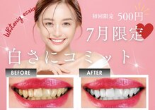 エクシアホワイト 宮崎花ヶ島店