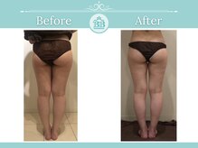 美人バスト 犬山店/下半身ダイエット】症例♪