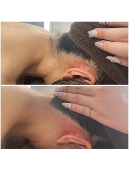 ミース 北九州店/うなじ○ビフォーアフター