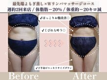 ヨサパーク プラーナ 千歳烏山店(YOSA PARK)/ビフォーアフター