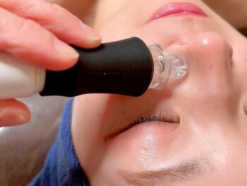 リフレ21(Refre21)の写真/イチゴ鼻卒業【毛穴レス♪毛穴をスッキリ徹底洗浄★¥3980】詰まった毛穴汚れをごっそり♪黒ずみ・角栓除去 