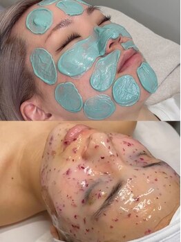 アディクト 恵比寿店(ADDICT)の写真/【顔全体WAX＋濃密保湿パック】産毛・角質・毛穴汚れをオフして、内側から潤い満ちる“発光美肌”へ★