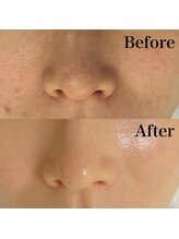 リレイスフクオカ(RelaceFUKUOKA)/セラピール