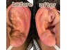 ≪見られてます！耳元ケア！≫耳毛脱毛