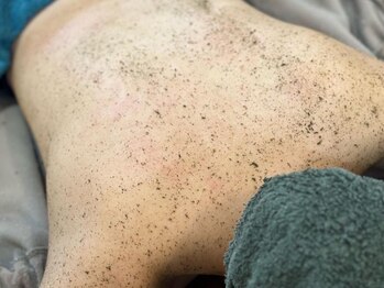 サロンドフェイス(Salon de Faith)/背中ハーブピーリング