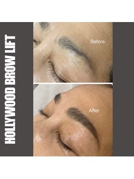 セラス(CERAS)/ハリウッドブロウリフト