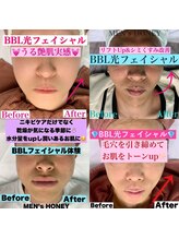 ハニーアイズ(Honey Eyes)/【BBLフェイシャル体験】