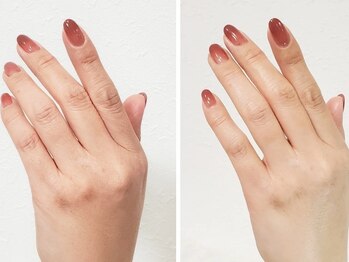 ネイル イコウ(nail ikou)の写真/年齢肌にアプローチ！透明感、キメが整う【角質サイクルを整えるハンドスパ】で触れたくなるもっちり手肌に