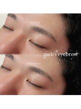 ルーフアイ(ROOF EYE)/ROOF EYE(ルーフ アイ)