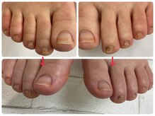 爪処 中野坂上/フットケア