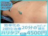 《国家資格保持》時短「鍼灸」2か所【ハリケアタイパ】スピード20分間 4500円