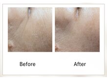 リル(Rire)/Before→After