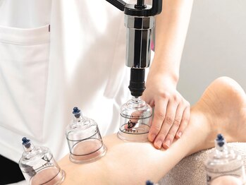 ブレア 銀座の写真/【鍼灸×カッピング】足のむくみや疲労を根本から改善!自律神経も同時に整えます!

