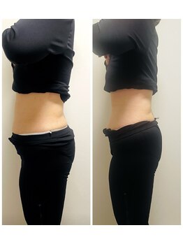 YOSAPARK Lulua/before*after