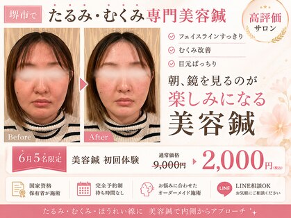 まつもと美容鍼灸整体サロンの写真