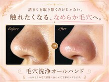ウー 上熊本(WOO)/【いちご鼻にはこれ】毛穴洗浄