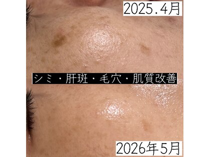 ベルエクラ(Bel Eclat)の写真