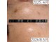 ベルエクラ(Bel Eclat)の写真