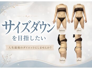ベルミーランド 浜松天王の写真/なかなか落ちない頑固なセル脂肪を分解!最新理論を基に全身痩身"新カラダ革命90分￥9900"で最後のダイエット