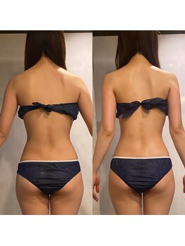 骨盤ストレッチ整体 b/姿勢改善は猫背矯正がおすすめ♪