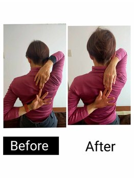 アース エンジェル整体院/ビフォアフ 肩甲骨はがし