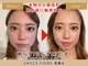 グレースフィオーレ 那覇店(gracefiore)の写真