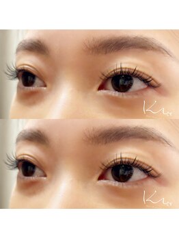 クレー(Klee)/フラットラッシュ