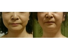 りんぱサロン まり/お客様のbefore→after