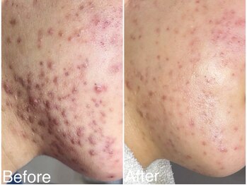 ラブリボン/短期プログラム