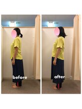 みらい整骨院/産前からの反り腰も改善