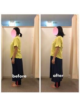 みらい整骨院/産前からの反り腰も改善